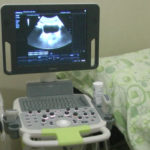 Zdravstveni centar Zaječar dobio je novi ultrazvučni aparat