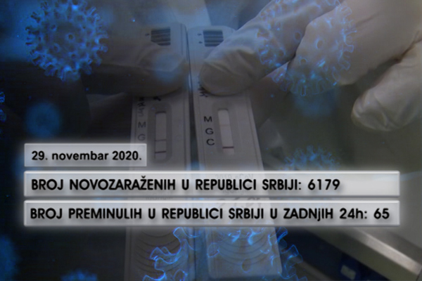 U Srbiji preminulo 65 osoba u poslednja 24 sata od COVID-19